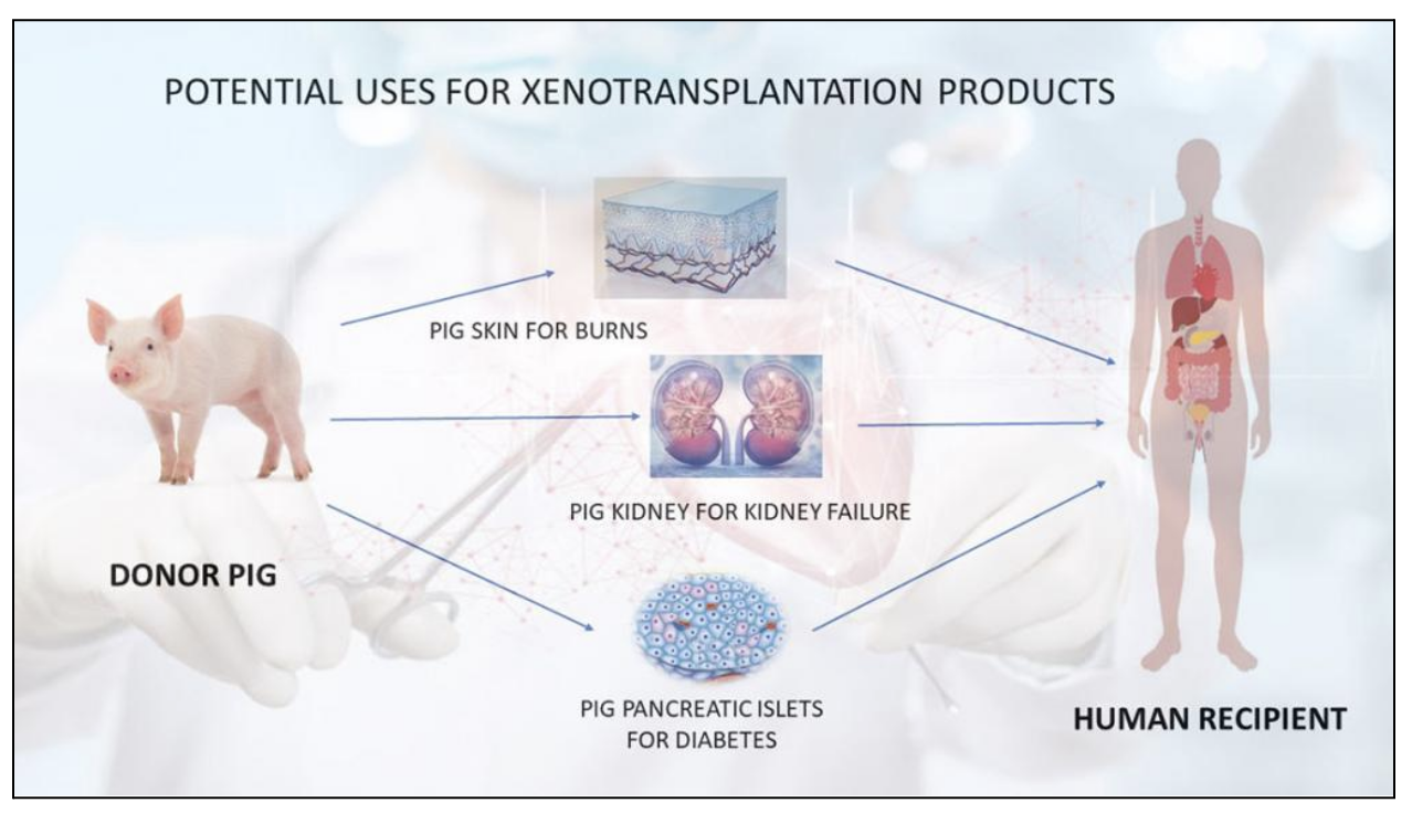What is Xenotransplantation
